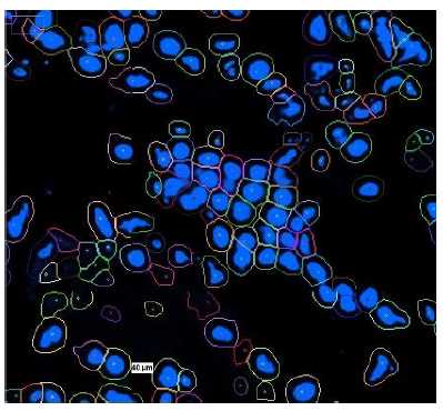Segmentation mask showing nuclear signal based cell segmentation Segmentation mask showing nuclear signal based cell segmentation