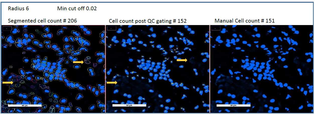 Quality control gating to eliminate artifacts and false segmentation Quality control gating to eliminate artifacts and false segmentation