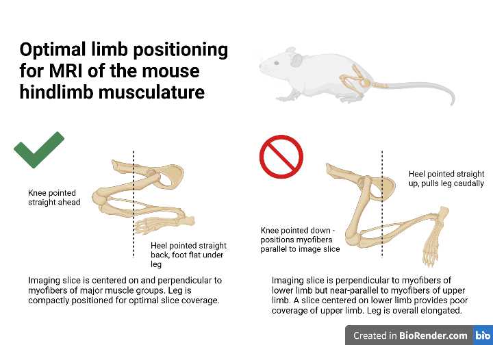 Diagram demonstrating optimal leg positioning. Diagram demonstrating optimal leg positioning.