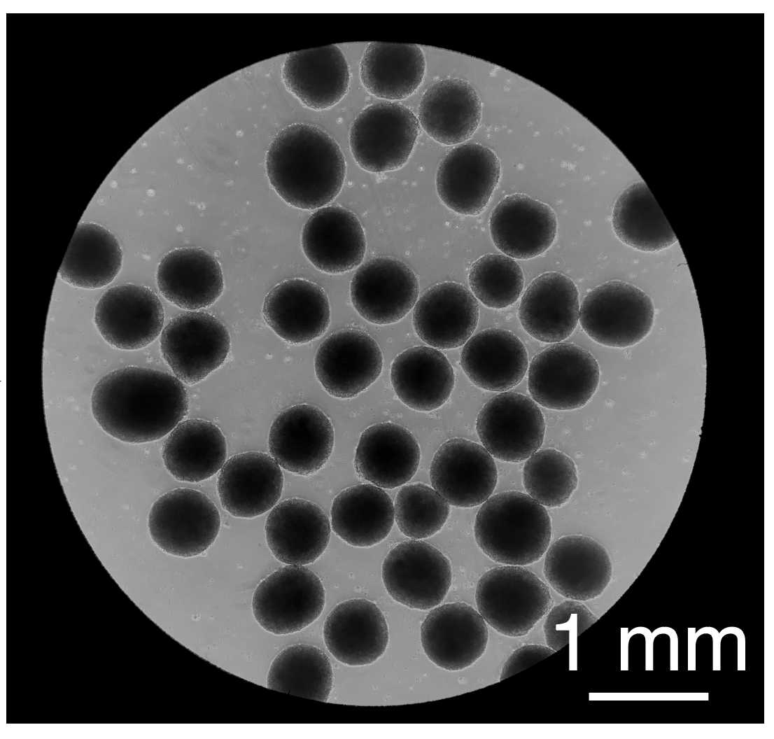Representative images of spheroids. Representative images of spheroids.
