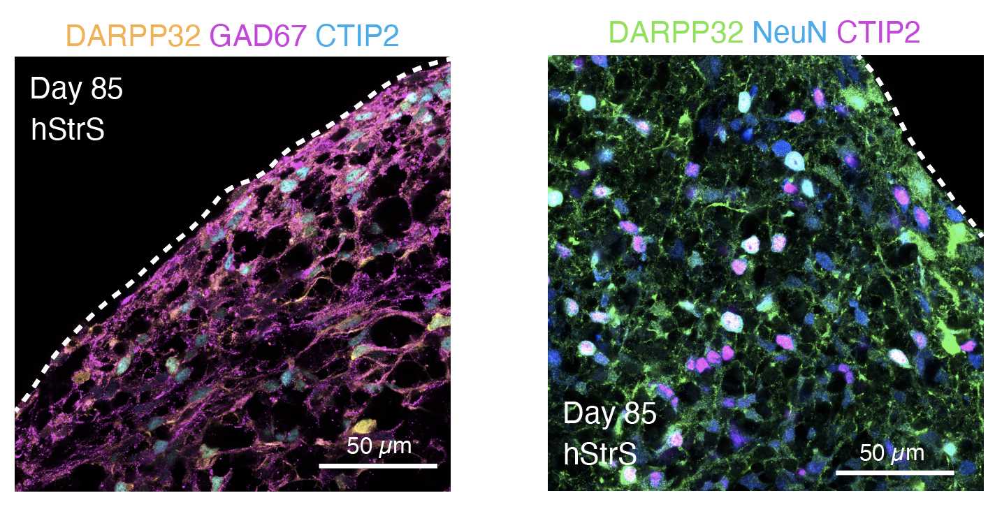 Left: Image showing immunostaining for DARPP32 (yellow), GAD67 (magenta) and CTIP2 (cyan) in an hStrS at day 85. Right: Image showing immunostaining for DARPP32 (green), NeuN (cyan) and CTIP2 (magenta) in an hStrS at day 85. Left: Image showing immunostaining for DARPP32 (yellow), GAD67 (magenta) and CTIP2 (cyan) in an hStrS at day 85. Right: Image showing immunostaining for DARPP32 (green), NeuN (cyan) and CTIP2 (magenta) in an hStrS at day 85.