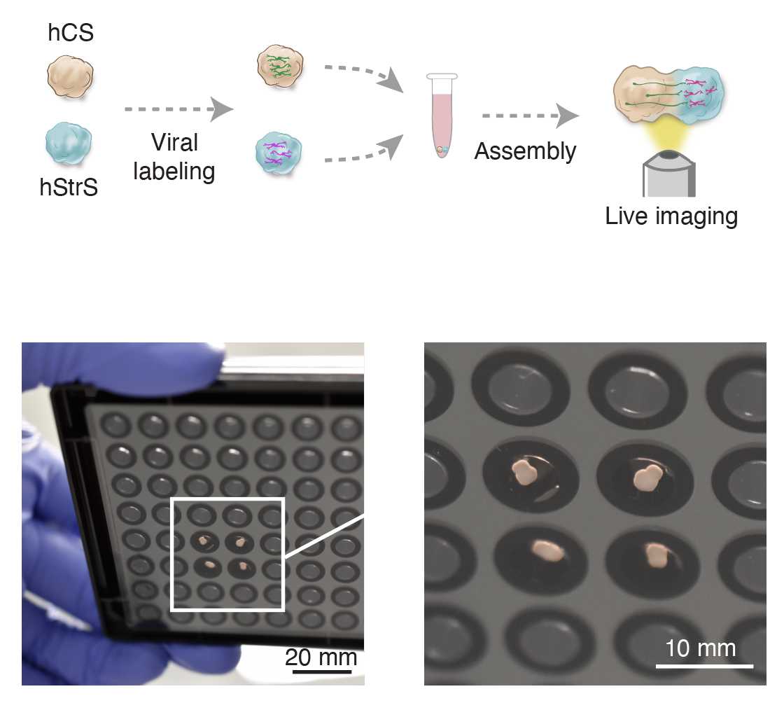 Scheme and images illustrating viral labeling, assembly and live imaging of cortico-striatal assembloids after their transfer into 96-well plates. Scheme and images illustrating viral labeling, assembly and live imaging of cortico-striatal assembloids after their transfer into 96-well plates.
