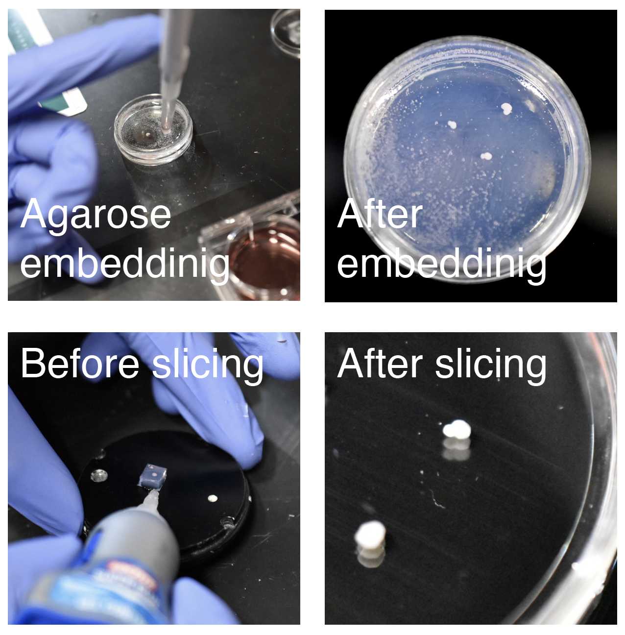 Images showing the process of agarose embedding and slicing of cortico-striatal assembloids. Images showing the process of agarose embedding and slicing of cortico-striatal assembloids.