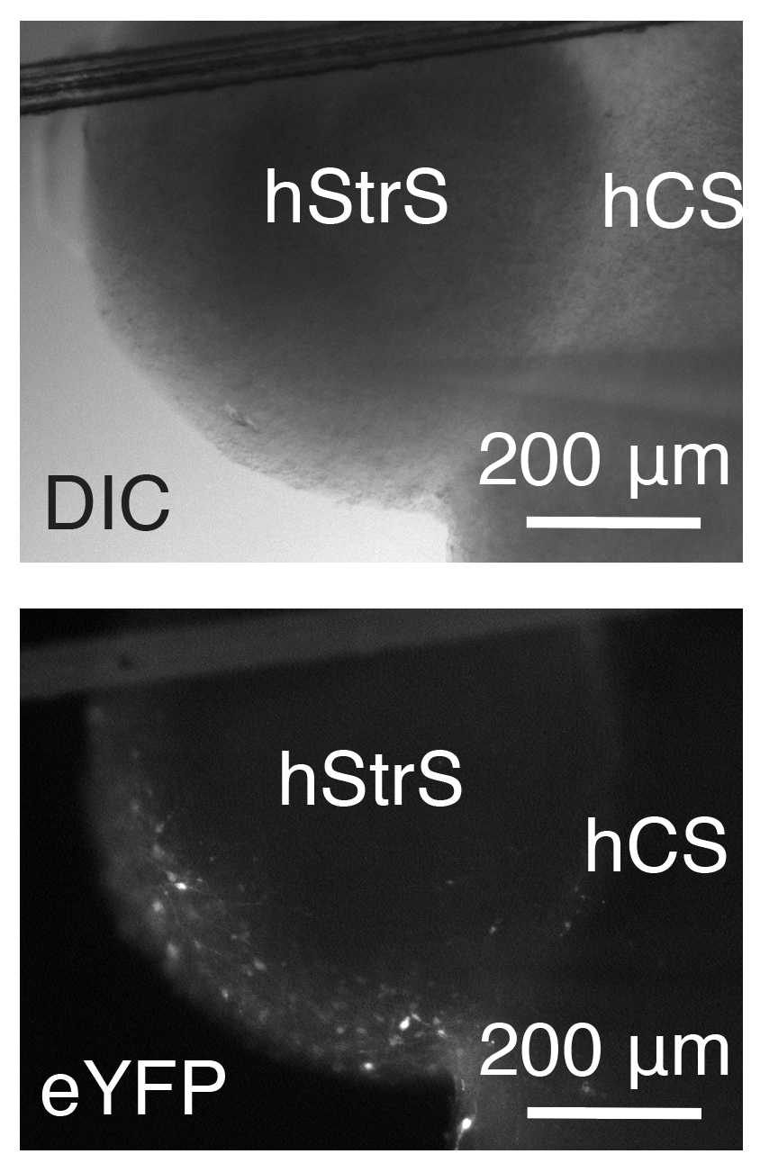 DIC (top) andfluorescent (bottom) images of sliced cortico-striatal assembloids expressing eYFP in an hStrS. DIC (top) andfluorescent (bottom) images of sliced cortico-striatal assembloids expressing eYFP in an hStrS.