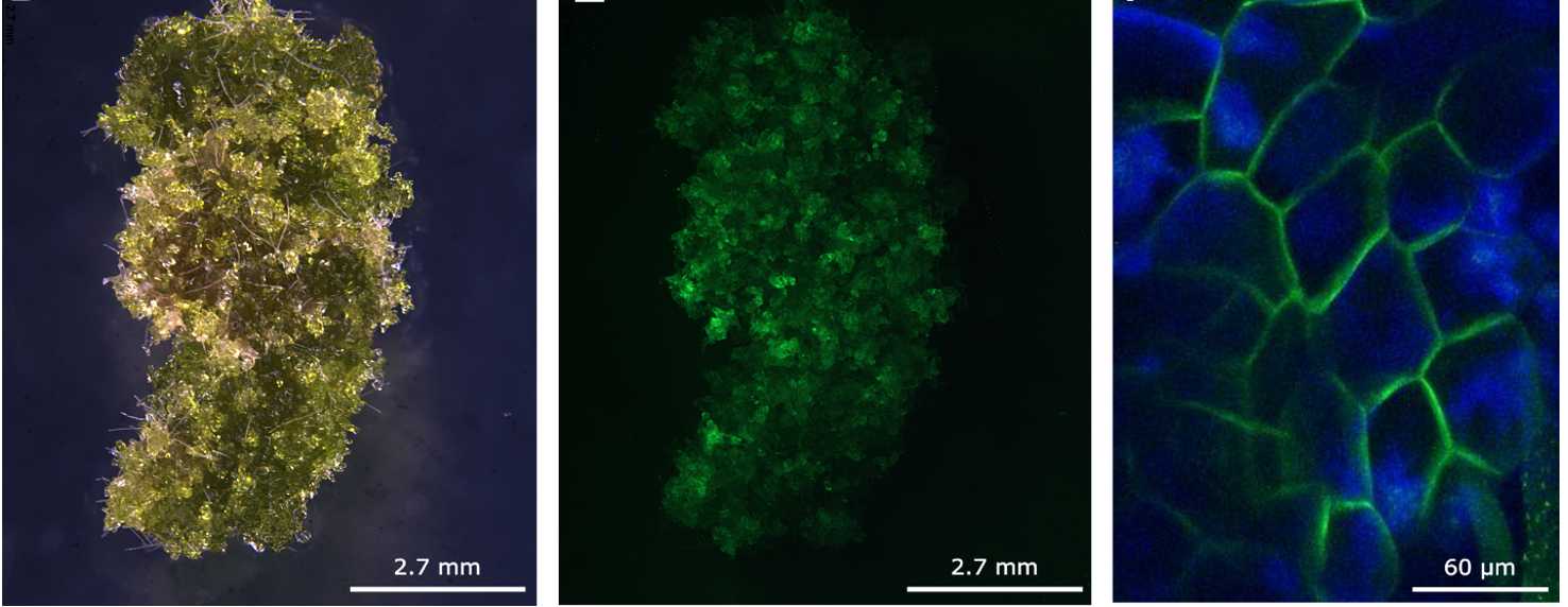 Figure 9. A. agrestis thallus tissue stably expressing plasma membrane localised GFP. Figure 9. A. agrestis thallus tissue stably expressing plasma membrane localised GFP.