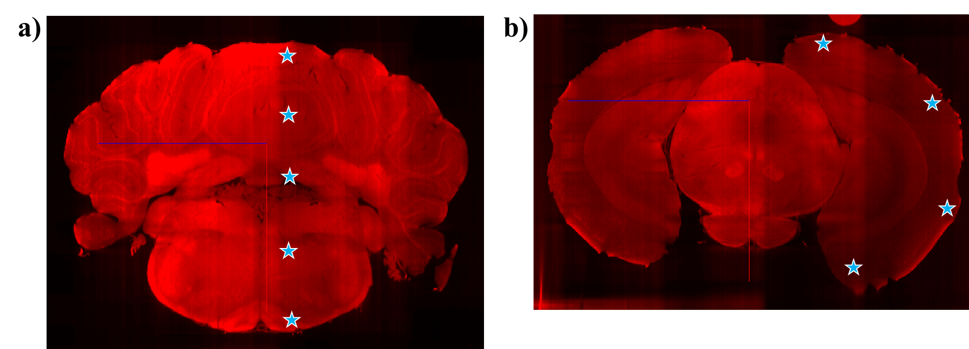 a) An ideal path straight down along the midline of the brain, b) for shorter wavelengths or samples with improper clearing, it may be necessary to perform focus adjustments in z along the edge of the brain. a) An ideal path straight down along the midline of the brain, b) for shorter wavelengths or samples with improper clearing, it may be necessary to perform focus adjustments in z along the edge of the brain.