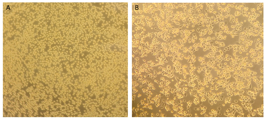 Figure 1: Morphology of THP-1 cells under inverted microscope (magnification: 10 x). A: Monocytes B: Macrophages after 96 h of differentiation with PMA. Figure 1: Morphology of THP-1 cells under inverted microscope (magnification: 10 x). A: Monocytes B: Macrophages after 96 h of differentiation with PMA.