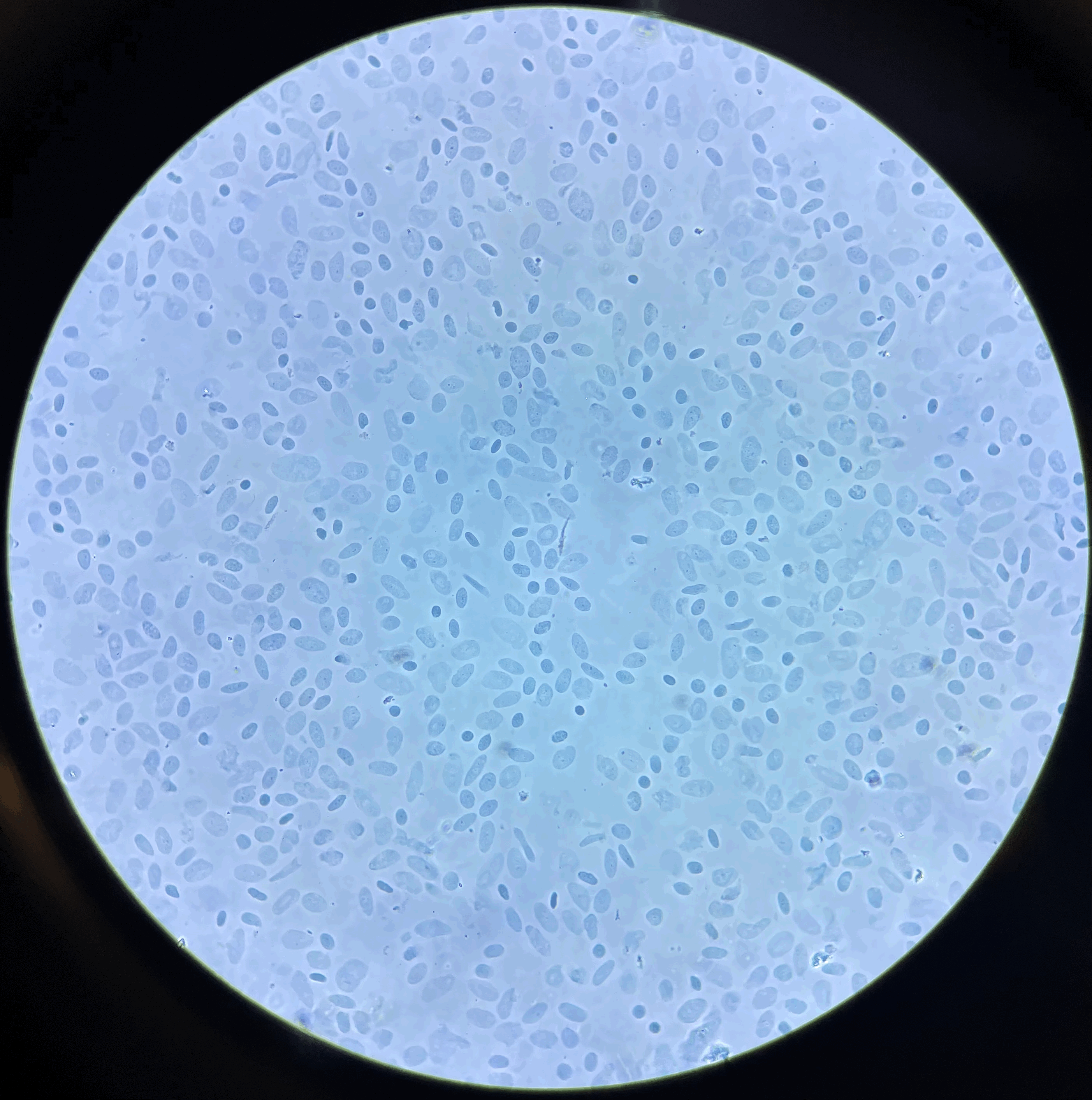 Representative image of nuclei isolated from fallopian tube. Representative image of nuclei isolated from fallopian tube.