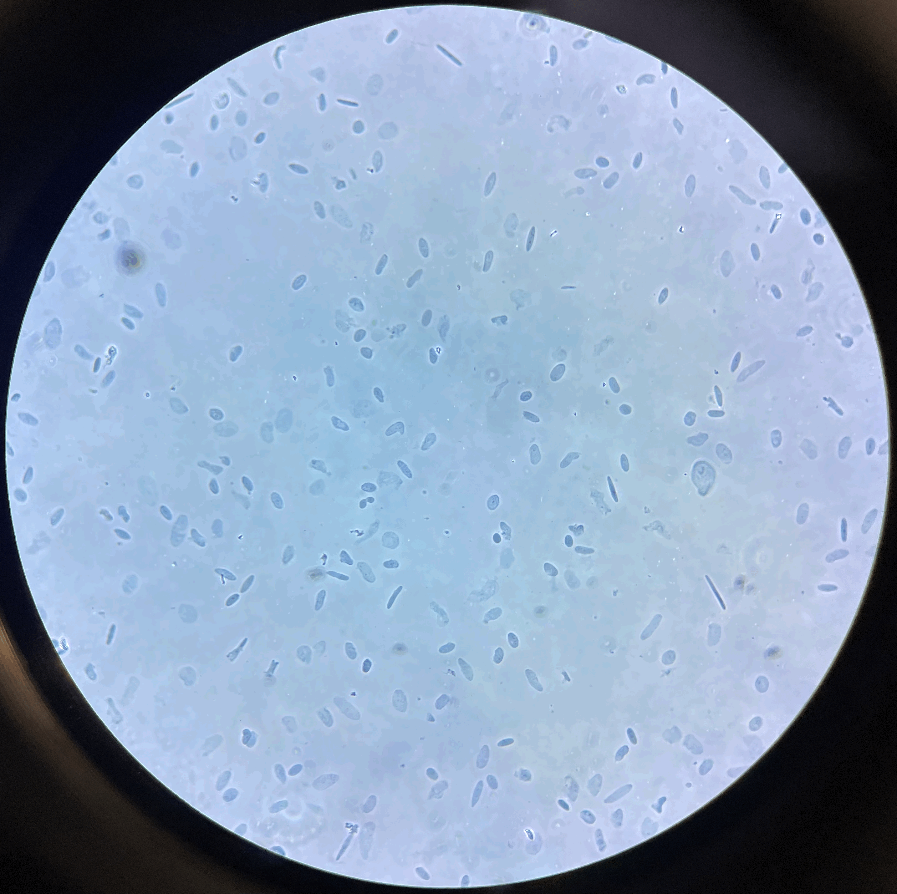 Representative image of nuclei isolated from uterine endomyometrium. Representative image of nuclei isolated from uterine endomyometrium.