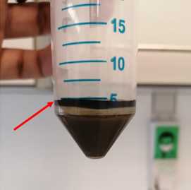 Figure 6. Floating fraction containing starch grains and other particles with the same gravimetry. Figure 6. Floating fraction containing starch grains and other particles with the same gravimetry.