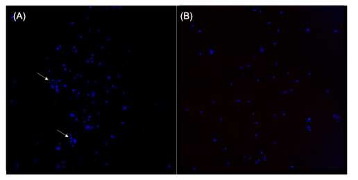 Figure 2. Examples of isolated nuclei stained with DAPI illustrating (A) areas of nuclei clumping and (B) evenly distributed, single nuclei. Figure 2. Examples of isolated nuclei stained with DAPI illustrating (A) areas of nuclei clumping and (B) evenly distributed, single nuclei.