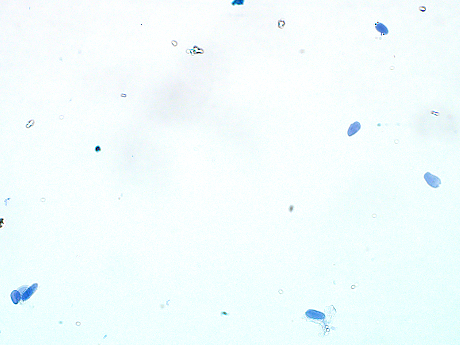 This photo shows sorted and permeabilized nuclei stained with Trypan Blue at 40x magnification. This photo shows sorted and permeabilized nuclei stained with Trypan Blue at 40x magnification.