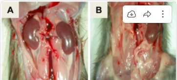 Representative renal anomalies observed in rats. A. Grossly normal renal development. B. Unilateral renal agenesis (URA) PloS one. 10. e0118147. 10.1371/journal.pone.0118147 Representative renal anomalies observed in rats. A. Grossly normal renal development. B. Unilateral renal agenesis (URA) PloS one. 10. e0118147. 10.1371/journal.pone.0118147
