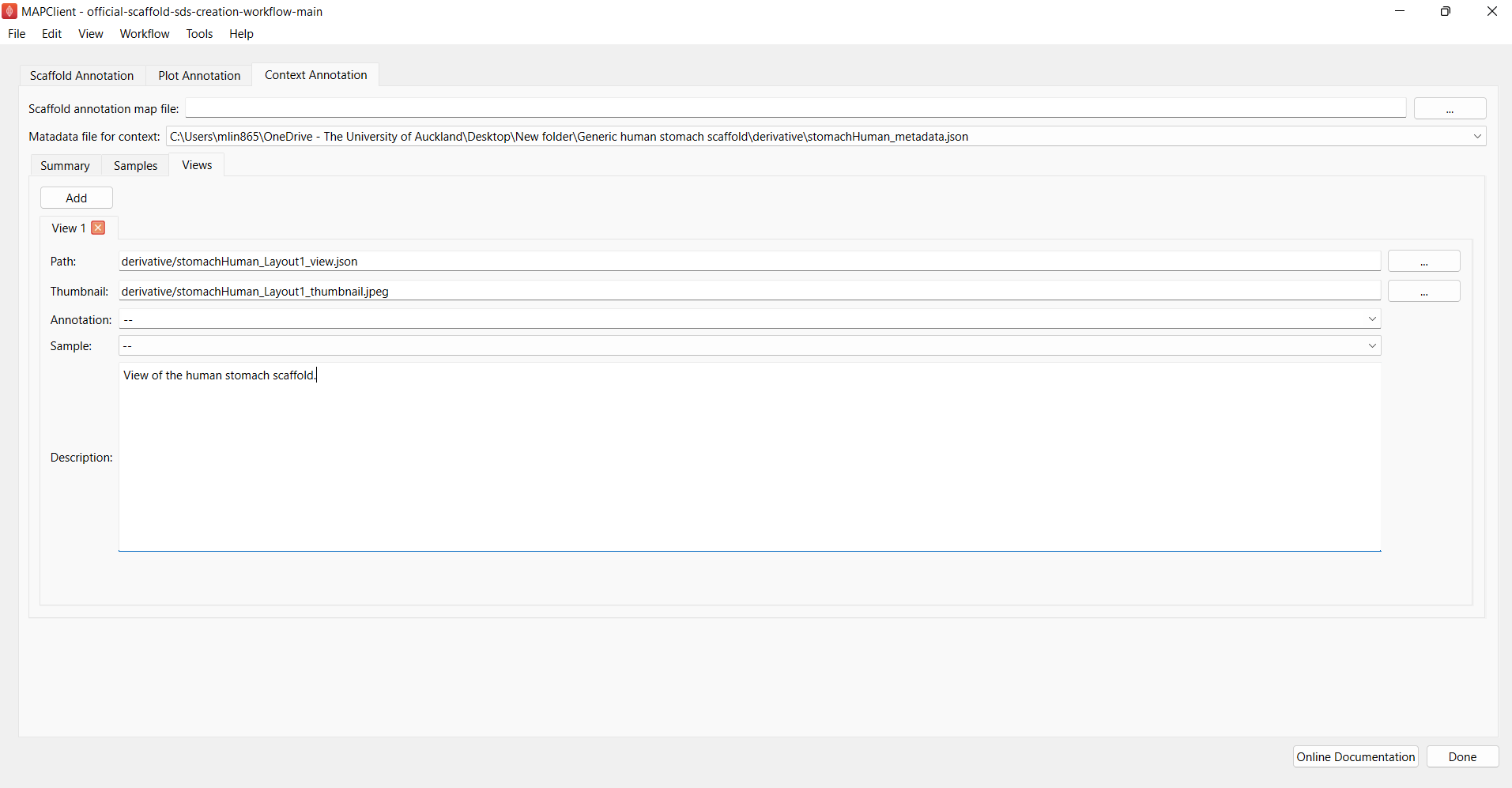 Figure 12. Adding views to the context card. Figure 12. Adding views to the context card.