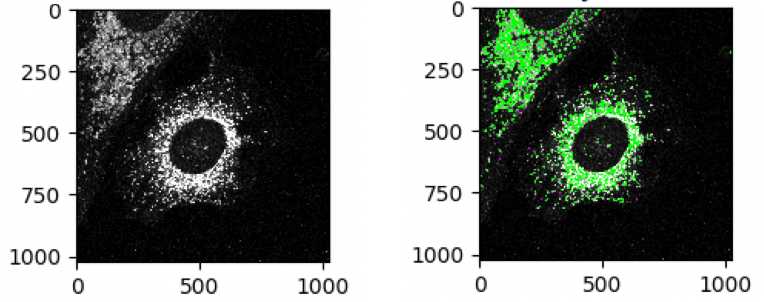 Figure 1: Lysosomes in MEF cells stained using anti-LAMP1 (left) and the LAMP1 objects identified by CellProfiler (right). Green regions represent valid objects. Figure 1: Lysosomes in MEF cells stained using anti-LAMP1 (left) and the LAMP1 objects identified by CellProfiler (right). Green regions represent valid objects.