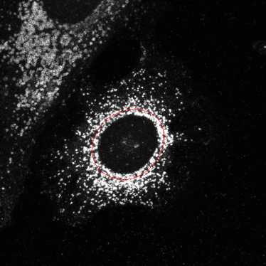 Figure 3: The red outline indicates the region within 20 pixels of the nucleus.
Figure 3: The red outline indicates the region within 20 pixels of the nucleus.
