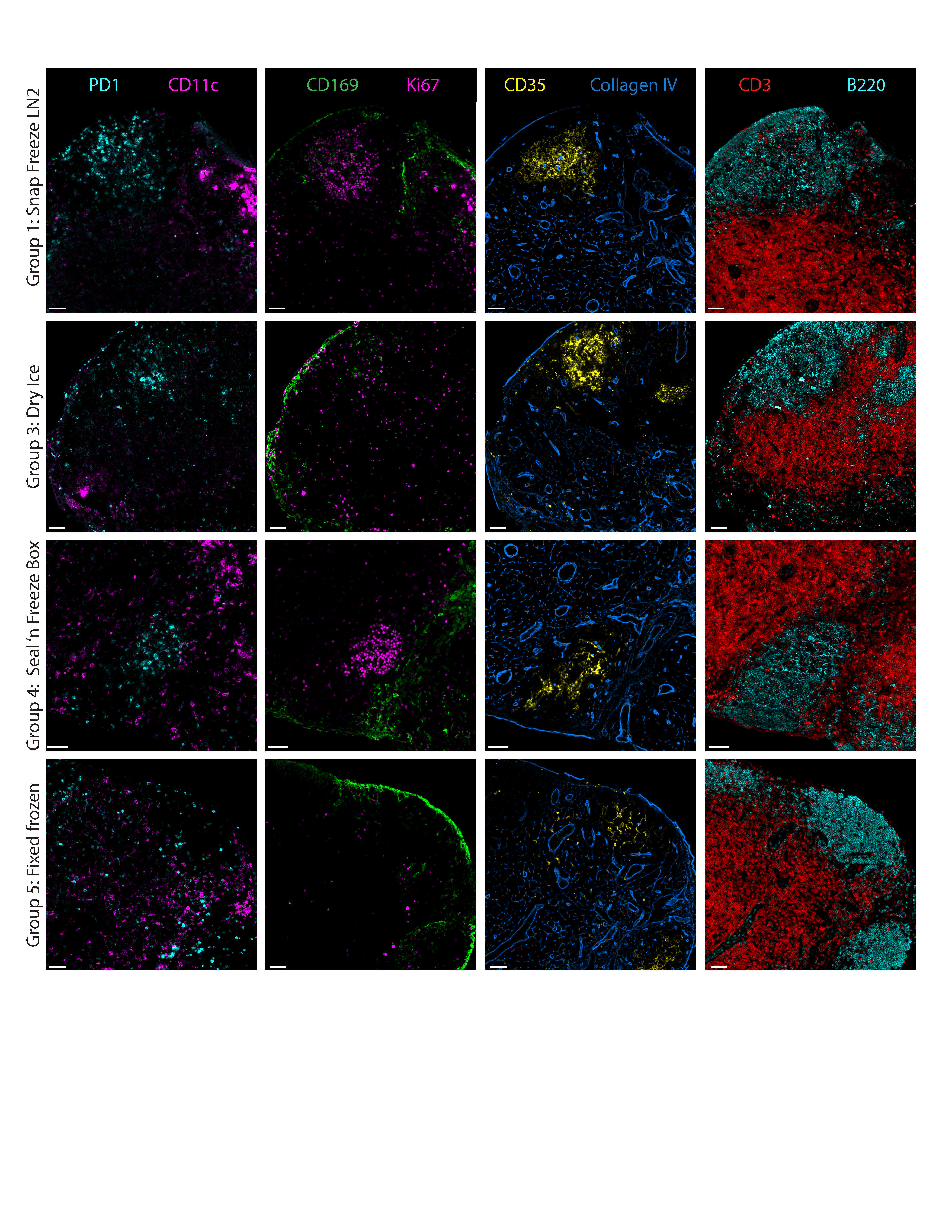 Figure 1. Representative lymph node immunofluorescence imaging of post-fixed sections from each treatment group. Each row shows 4 pairs of markers that were imaged sequentially, and each column shows one pair of marker across 4 different groups. Group 2 was not included because the tissue block split during cryosectioning due to uneven freezing as detailed in the NYU Langone protocol shared in Step 2. Although Groups 1 and 3 showed positive labeling of all antibodies, antibodies directed against B220 and CD3 did not yield images as sharp as Groups 4 and 5 (control). Scale bar denotes X um. Figure 1. Representative lymph node immunofluorescence imaging of post-fixed sections from each treatment group. Each row shows 4 pairs of markers that were imaged sequentially, and each column shows one pair of marker across 4 different groups. Group 2 was not included because the tissue block split during cryosectioning due to uneven freezing as detailed in the NYU Langone protocol shared in Step 2. Although Groups 1 and 3 showed positive labeling of all antibodies, antibodies directed against B220 and CD3 did not yield images as sharp as Groups 4 and 5 (control). Scale bar denotes X um.