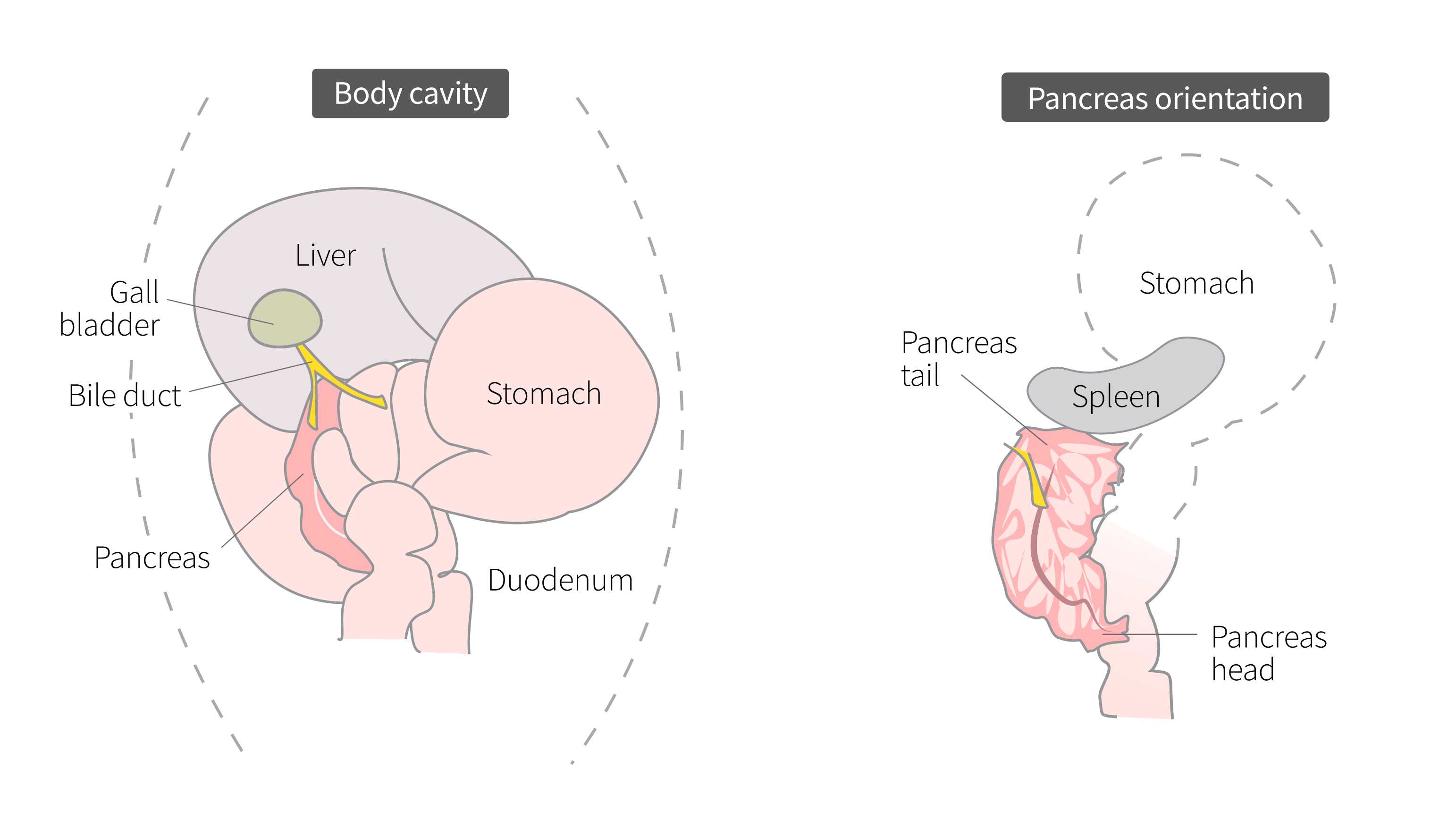 Above left: Pancreas location relative to other internal organs.Above right: Pancreas tail attaches to spleen; pancreas head attaches to duodenum. Above left: Pancreas location relative to other internal organs.Above right: Pancreas tail attaches to spleen; pancreas head attaches to duodenum.