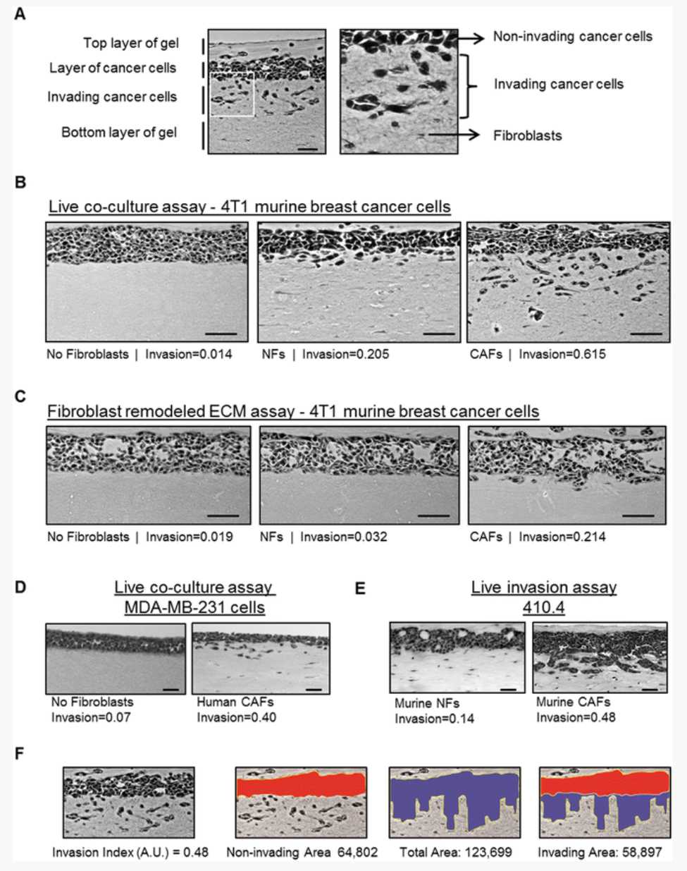 Fig. 3Analysis of cancer cell invasion using carcinoma cells in an organotypic invasion assay. (a) Representative image of H&E staining of an organotypic invasion assay of 4T1 cells cultured in the presence of CAFs. The different parts of the organotypic gel are indicated. Right panel is a zoom up region that shows both collective and single cell invasion of 4T1 cells. Fibroblasts and ECM fibers are also observed. (b) Representative images of H&E staining of organotypic invasion assays of 4T1 murine breast cancer cells cultured in the absence and presence of either murine normal fibroblasts (NFs) or PyMT-CAFs. Invasion indexes of 4T1 cells for each experimental setup are also indicated. Scale bar, 50 μm. (c) Representative images of H&E staining of “killing” organotypic invasion assays of 4T1 murine breast cancer cells cultured in gels previously remodeled by murine normal fibroblasts, PyMT-CAFs or mock-remodeled (no fibroblasts). Invasion indexes of 4T1 cells for each experimental set-up are also indicated. Scale bar, 50 μm. (d) Representative images of H&E staining of organotypic invasion assays of MDA-MB-231 human breast cancer cells cultured in the absence and presence of human breast cancer CAFs . The invasion index is indicated. Scale bar, 50 μm. (e) Representative images of H&E staining of organotypic invasion assays of 410.4 murine breast cancer cells with murine NFs and CAFs . Note that 410.4 cells present a “collective” mode of invasion. Scale bar, 50 μm. (f) Exemplars for image analysis of a representative image of H&E staining of an organotypic invasion assay of 4T1 cells cultured in the presence of CAFs (shown in panel a). First, the non-invaded area (red) and the total area (blue) are measured using Image J (http://imagej.nih.gov/ij/). The invading area is then calculated by subtracting the non-invading area from the total area. The invasion index is the ratio of invaded area vs. total area. Invasion index and areas are also indicated Fig. 3Analysis of cancer cell invasion using carcinoma cells in an organotypic invasion assay. (a) Representative image of H&E staining of an organotypic invasion assay of 4T1 cells cultured in the presence of CAFs. The different parts of the organotypic gel are indicated. Right panel is a zoom up region that shows both collective and single cell invasion of 4T1 cells. Fibroblasts and ECM fibers are also observed. (b) Representative images of H&E staining of organotypic invasion assays of 4T1 murine breast cancer cells cultured in the absence and presence of either murine normal fibroblasts (NFs) or PyMT-CAFs. Invasion indexes of 4T1 cells for each experimental setup are also indicated. Scale bar, 50 μm. (c) Representative images of H&E staining of “killing” organotypic invasion assays of 4T1 murine breast cancer cells cultured in gels previously remodeled by murine normal fibroblasts, PyMT-CAFs or mock-remodeled (no fibroblasts). Invasion indexes of 4T1 cells for each experimental set-up are also indicated. Scale bar, 50 μm. (d) Representative images of H&E staining of organotypic invasion assays of MDA-MB-231 human breast cancer cells cultured in the absence and presence of human breast cancer CAFs . The invasion index is indicated. Scale bar, 50 μm. (e) Representative images of H&E staining of organotypic invasion assays of 410.4 murine breast cancer cells with murine NFs and CAFs . Note that 410.4 cells present a “collective” mode of invasion. Scale bar, 50 μm. (f) Exemplars for image analysis of a representative image of H&E staining of an organotypic invasion assay of 4T1 cells cultured in the presence of CAFs (shown in panel a). First, the non-invaded area (red) and the total area (blue) are measured using Image J (http://imagej.nih.gov/ij/). The invading area is then calculated by subtracting the non-invading area from the total area. The invasion index is the ratio of invaded area vs. total area. Invasion index and areas are also indicated
