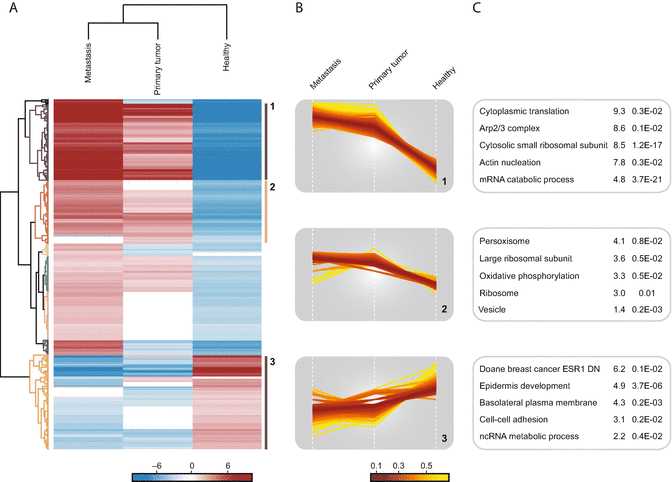 Fig. 5Enrichment analysis highlighting important pathways and processes. (a) Hierarchical clustering of proteins found to have differential expression between pairs of disease states. High and low expression are shown in red and blue respectively. Various clusters of protein groups are highlighted in the dendrogram. (b) Profile plots of three selected clusters showing distinct behavior with respect to the three disease states are shown: 1 strongly increased expression in tumor tissues; 2 moderate increase in tumor tissue; and 3 decreased expression in tumor samples. (c) Functional analysis of protein annotation terms resulted in multiple categories that were enriched in the three selected clusters. The enriched terms and the corresponding enrichment factor and p-value are shown Fig. 5Enrichment analysis highlighting important pathways and processes. (a) Hierarchical clustering of proteins found to have differential expression between pairs of disease states. High and low expression are shown in red and blue respectively. Various clusters of protein groups are highlighted in the dendrogram. (b) Profile plots of three selected clusters showing distinct behavior with respect to the three disease states are shown: 1 strongly increased expression in tumor tissues; 2 moderate increase in tumor tissue; and 3 decreased expression in tumor samples. (c) Functional analysis of protein annotation terms resulted in multiple categories that were enriched in the three selected clusters. The enriched terms and the corresponding enrichment factor and p-value are shown