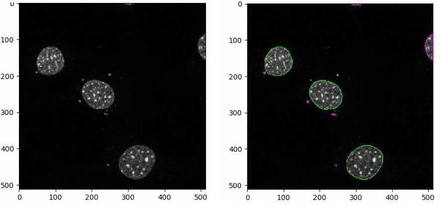 Figure 1: Nuclei in the input image(left) and nuclei identified as objects by CellProfiler (right). Green outlines represent valid objects. Figure 1: Nuclei in the input image(left) and nuclei identified as objects by CellProfiler (right). Green outlines represent valid objects.