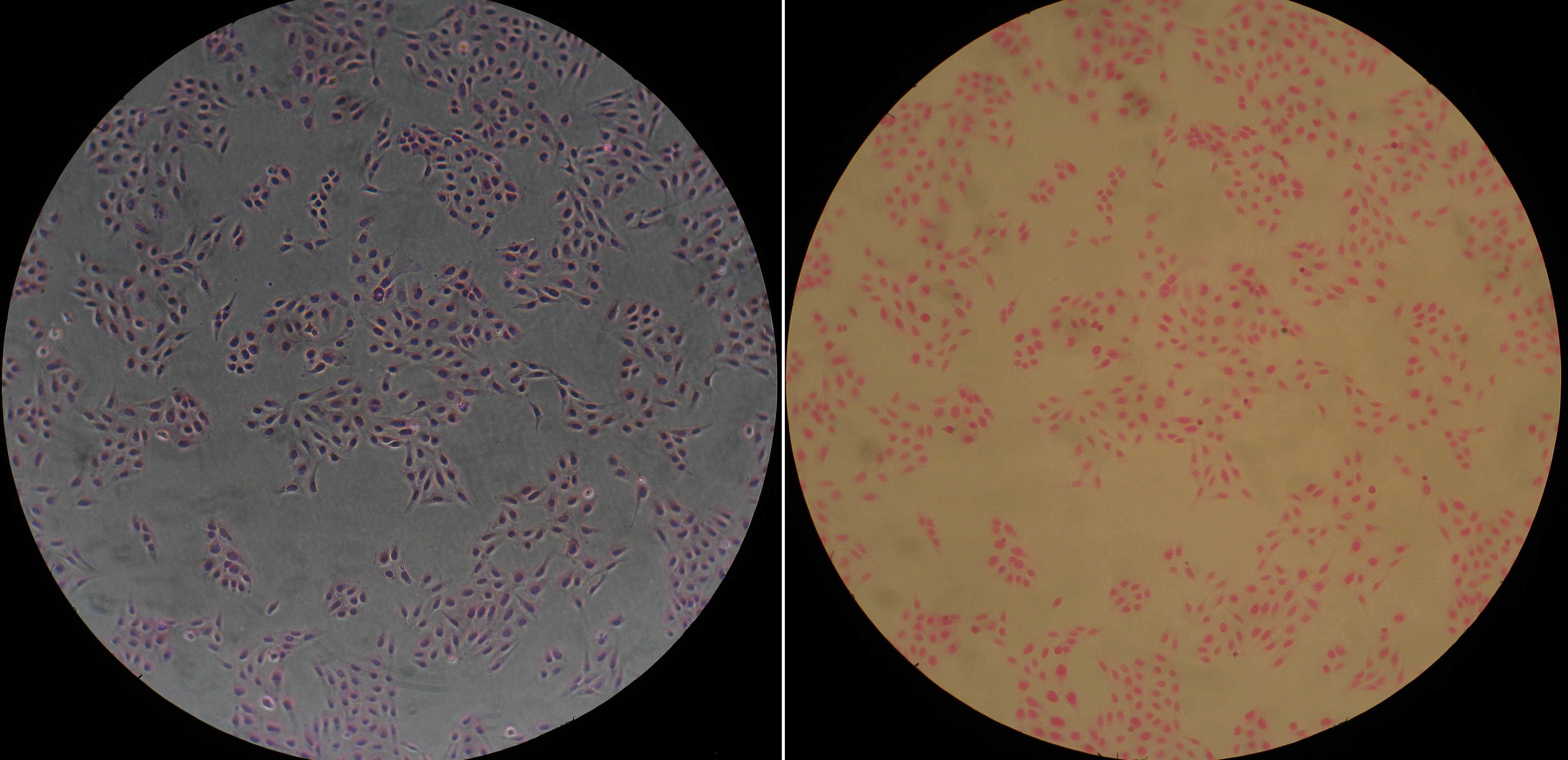 Image of (initially) live U2OS cells stained with ErB. Left: phase contrast image; Right: brightfield image. Cells were grown and stained in wells of a 24-well TC-treated polystyrene plate. Image of (initially) live U2OS cells stained with ErB. Left: phase contrast image; Right: brightfield image. Cells were grown and stained in wells of a 24-well TC-treated polystyrene plate.