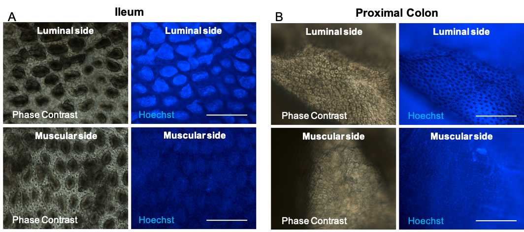 Fig 4. Tissue orientation under microscopy for mounting.Immunostained tissues were visualized under an upright light/epifluorescence microscopy to identify the tissue orientation to mount them with the luminal side up. Representative phase-contrast and Hoechst staining micrograph of (A) ileum and (B) proximal colon with the luminal or muscular side up. Scale bar 400µm. Fig 4. Tissue orientation under microscopy for mounting.Immunostained tissues were visualized under an upright light/epifluorescence microscopy to identify the tissue orientation to mount them with the luminal side up. Representative phase-contrast and Hoechst staining micrograph of (A) ileum and (B) proximal colon with the luminal or muscular side up. Scale bar 400µm.