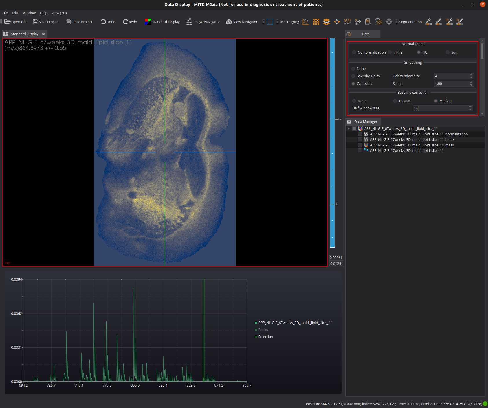 M²aia application with selected ion image at m/z 864.89 +/- 0.65 Da. M²aia application with selected ion image at m/z 864.89 +/- 0.65 Da.