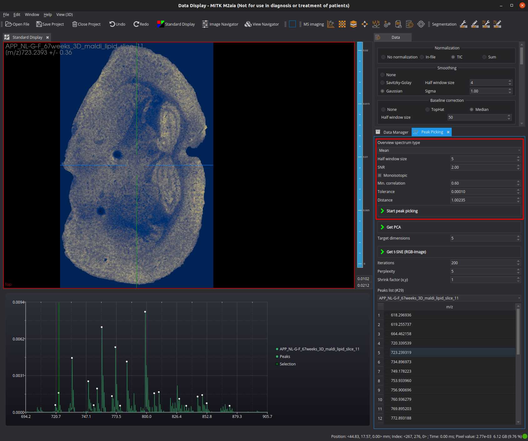 M²aia application with selected ion image at peak-of-interest (POI) m/z 723.23 +/- 0.36 Da. M²aia application with selected ion image at peak-of-interest (POI) m/z 723.23 +/- 0.36 Da.