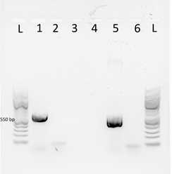 Figure 1: Agarose gel electrophoresis image showing the RT-PCR results confirming the Neomycin gene expression in Bodo saltans transformants at the expected size of 550- bp. (L) L= 100 bp Ladder(New England Biolabs); lanes (1) Neomycin expression profile in B. saltans cells transformed with eGFP-Neo-PFRplasmid; (2) Control reaction using the same extracted RNA from transfected B. saltanswithout the RT step toverify the absence of DNA after the DNase treatments(3) Wild-type RT-PCR confirm the absence of the Neomycin expression in wild type samples (4) Control reaction using the same extracted RNA from wild-type B. saltans without the RT step toverify the absence of DNA after the DNase treatments (4) PCR positive PCR control using the eGFP-Neo-PFR plasmid DNA; (5) PCR negative control. Forward and reverse PCR primers targeting the Neomycin gene are published in Faktorová et al. (2020). The PCR products were visualized under UV light using 1% agarose gel. Figure 1: Agarose gel electrophoresis image showing the RT-PCR results confirming the Neomycin gene expression in Bodo saltans transformants at the expected size of 550- bp. (L) L= 100 bp Ladder(New England Biolabs); lanes (1) Neomycin expression profile in B. saltans cells transformed with eGFP-Neo-PFRplasmid; (2) Control reaction using the same extracted RNA from transfected B. saltanswithout the RT step toverify the absence of DNA after the DNase treatments(3) Wild-type RT-PCR confirm the absence of the Neomycin expression in wild type samples (4) Control reaction using the same extracted RNA from wild-type B. saltans without the RT step toverify the absence of DNA after the DNase treatments (4) PCR positive PCR control using the eGFP-Neo-PFR plasmid DNA; (5) PCR negative control. Forward and reverse PCR primers targeting the Neomycin gene are published in Faktorová et al. (2020). The PCR products were visualized under UV light using 1% agarose gel.