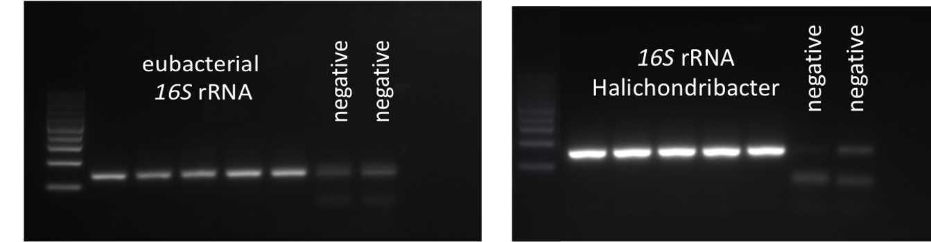 Figure: Example gel electrophoresis of qPCR products. Five replicate products and two negative controls were run per primer pair (eubacterial and Halichondribacter-specific 16S rRNA gene).Specificity of Halichondribacter-primers was confirmed by extraction of the gel band and sequencing of the PCR product. Regularly check qPCR products on a gel to confirm specificity and amplification of one product only. Figure: Example gel electrophoresis of qPCR products. Five replicate products and two negative controls were run per primer pair (eubacterial and Halichondribacter-specific 16S rRNA gene).Specificity of Halichondribacter-primers was confirmed by extraction of the gel band and sequencing of the PCR product. Regularly check qPCR products on a gel to confirm specificity and amplification of one product only.