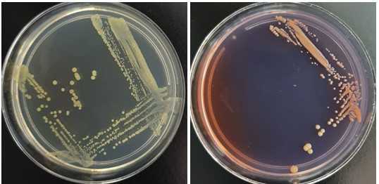 Curtobacterium flaccumfaciens pv. flaccumfaciens colonies on Nutrient Agar (left) and modified* MSCFF medium (right). *The MSCFF medium was prepared according to Maringoni et al. (2006b), except that sodium azide was not added to the medium. Curtobacterium flaccumfaciens pv. flaccumfaciens colonies on Nutrient Agar (left) and modified* MSCFF medium (right). *The MSCFF medium was prepared according to Maringoni et al. (2006b), except that sodium azide was not added to the medium.