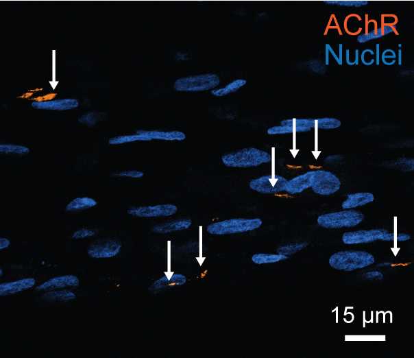 Figure 14. Confocal slice of AChR cluster staining (orange) with BTX-Alexa Fluor 555 at 40X magnification. Nuclei (blue) stained with Hoechst 33342 (1:200). Figure 14. Confocal slice of AChR cluster staining (orange) with BTX-Alexa Fluor 555 at 40X magnification. Nuclei (blue) stained with Hoechst 33342 (1:200).