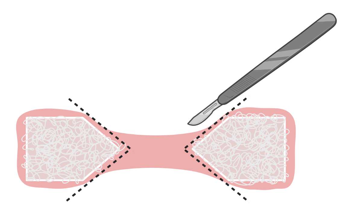 Figure 15. How to cut muscle constructs for staining and mounting. Figure 15. How to cut muscle constructs for staining and mounting.
