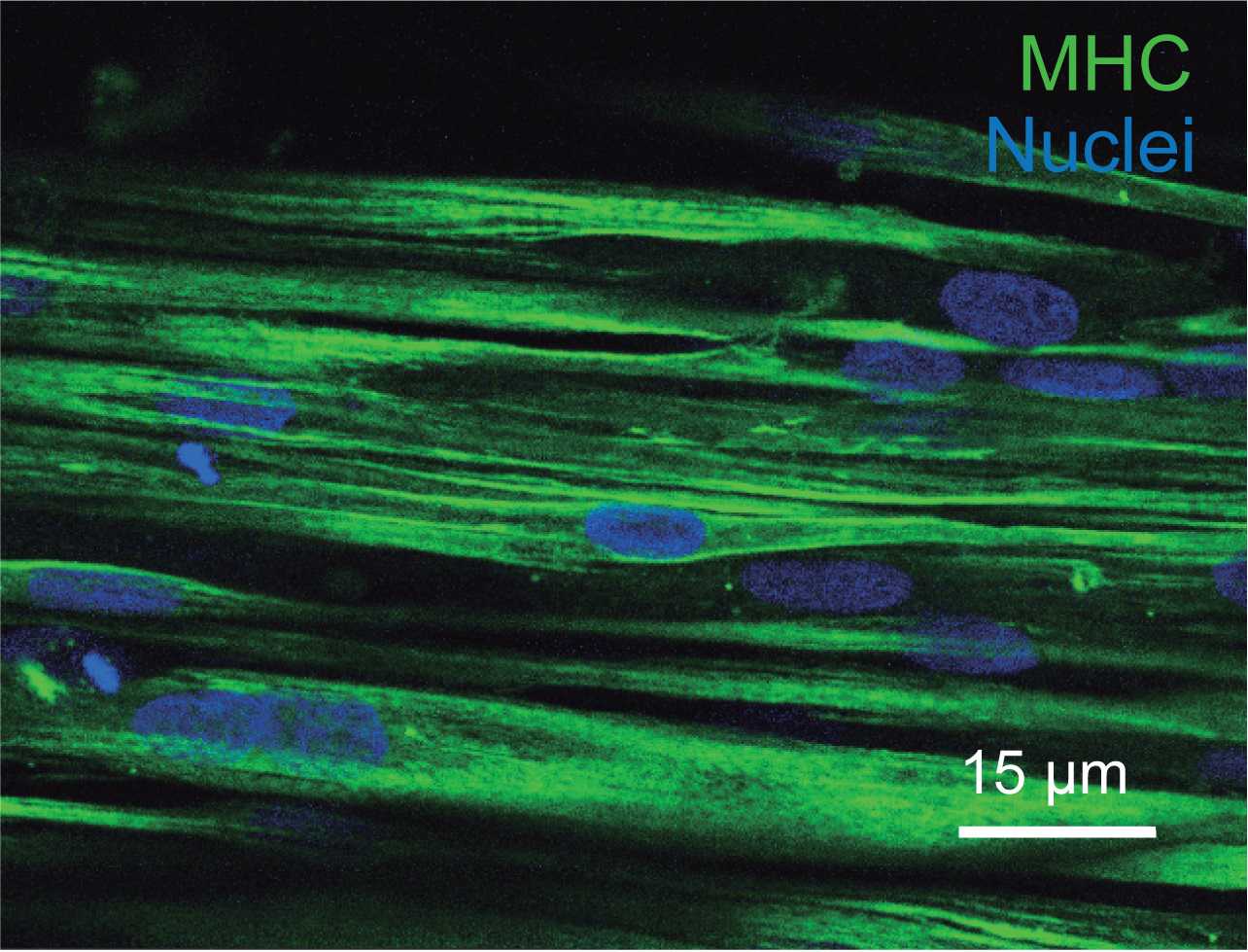 Figure 13. Confocal slice of MHC staining (green) at 40X magnification. Nuclei (blue) stained with Hoechst 33342. Figure 13. Confocal slice of MHC staining (green) at 40X magnification. Nuclei (blue) stained with Hoechst 33342.