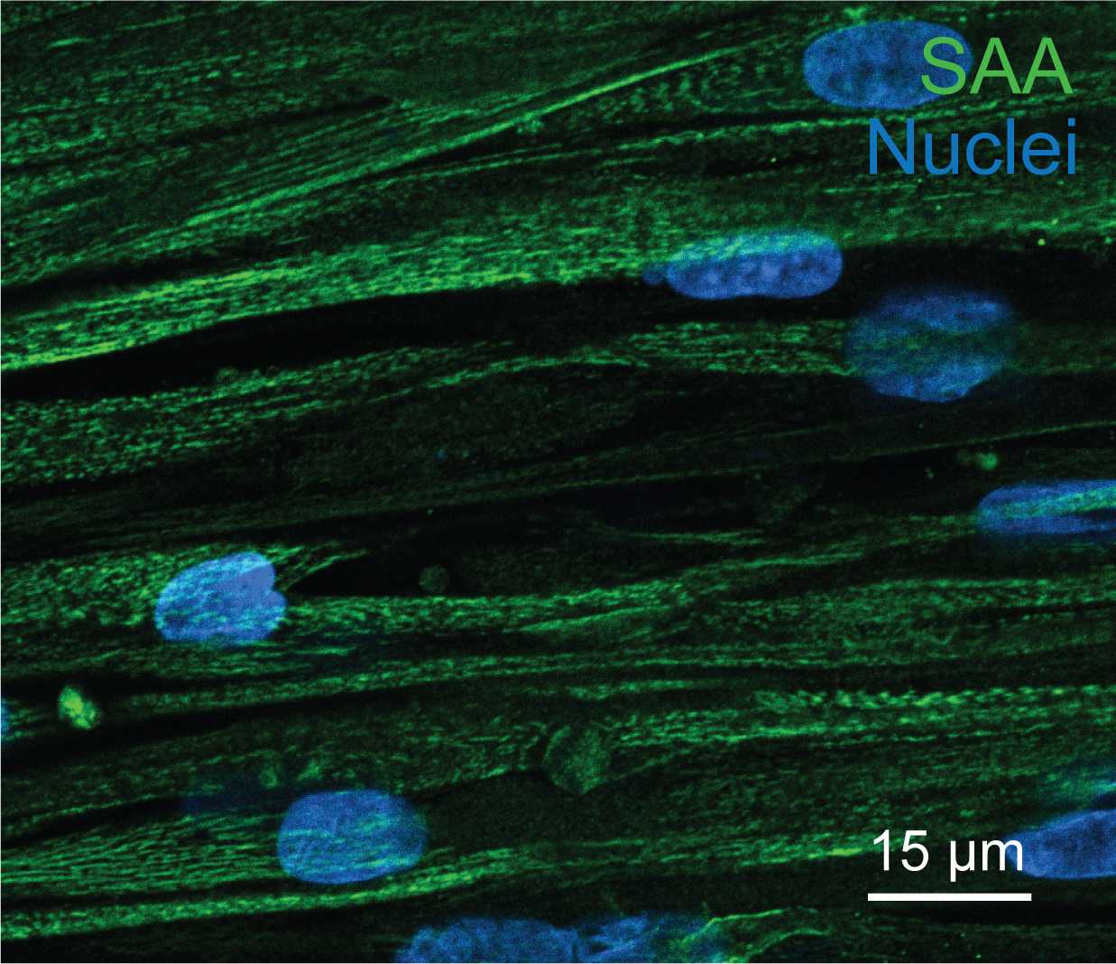 Figure 12. Confocal slice of SAA staining (green) at 40X magnification. Nuclei (blue) stained with Hoechst 33342. Figure 12. Confocal slice of SAA staining (green) at 40X magnification. Nuclei (blue) stained with Hoechst 33342.