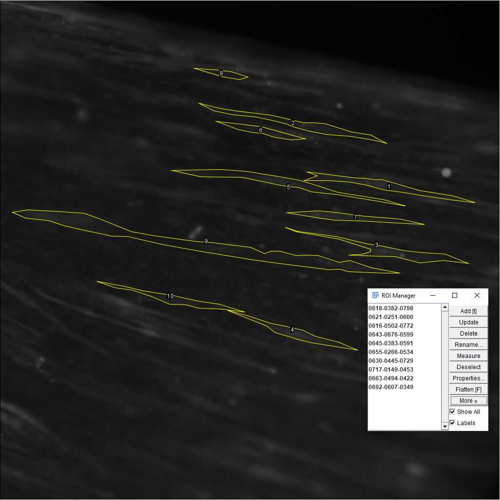 Figure 29. Example of 10 ROIs selected with the ImageJ ROI manager. Figure 29. Example of 10 ROIs selected with the ImageJ ROI manager.