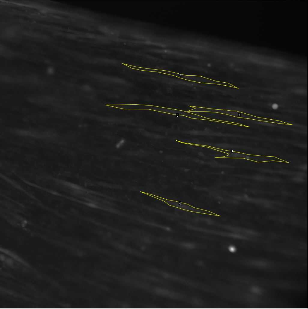 Figure 27. Five highlighted cells before any stimulation. Figure 27. Five highlighted cells before any stimulation.
