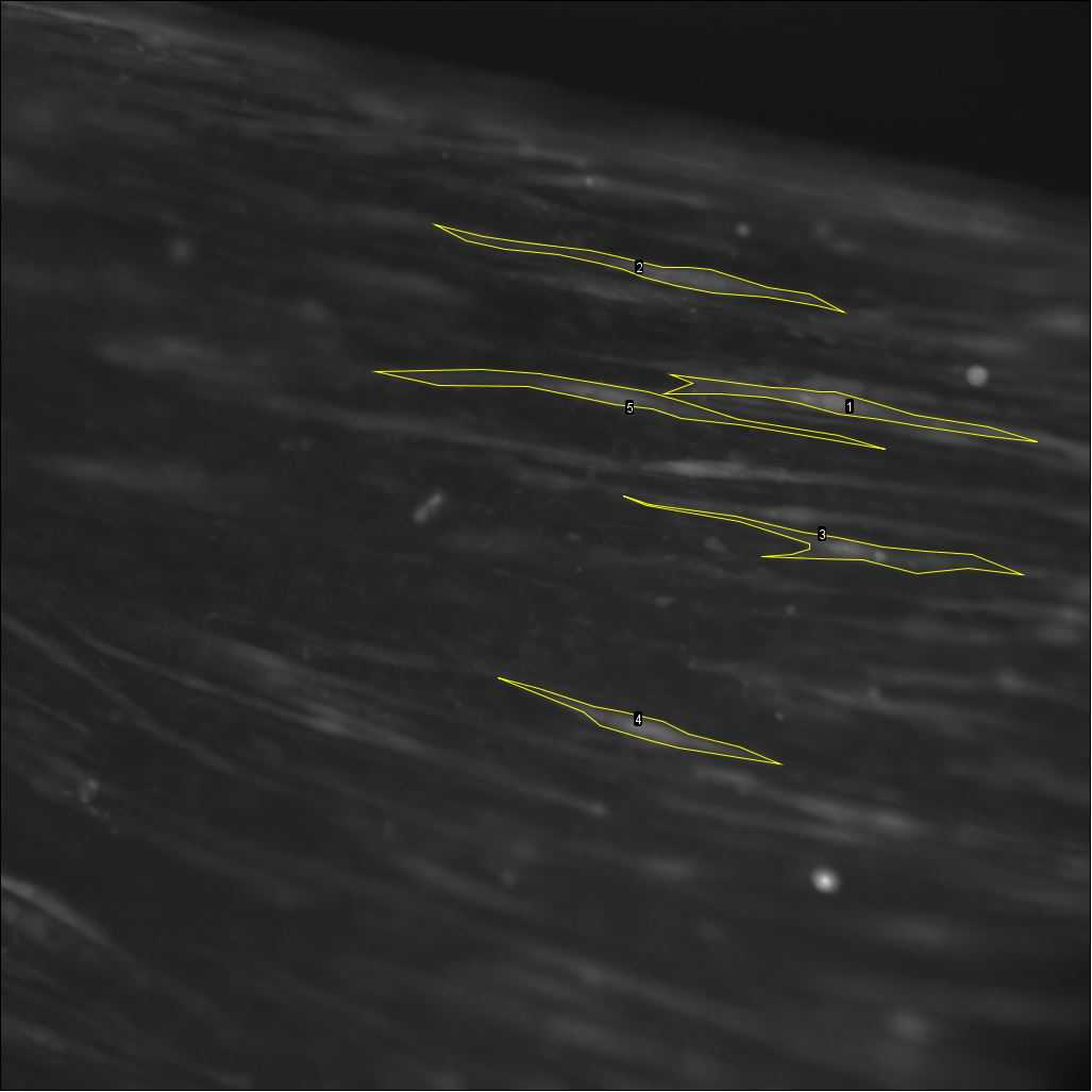 Figure 28. Five highlighted cells showing fluorescence increase after ACh stimulation. Figure 28. Five highlighted cells showing fluorescence increase after ACh stimulation.