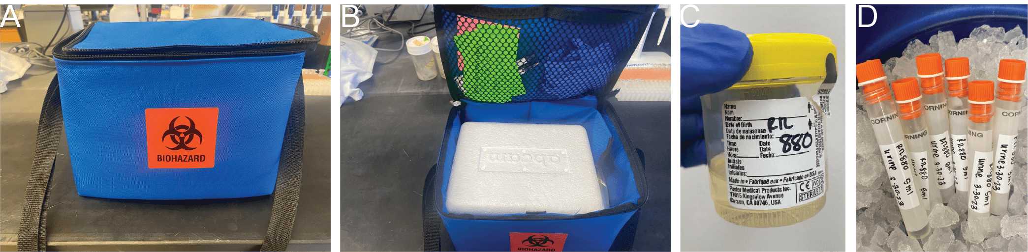 Fig. 1. Urine collection and processing overview. Urine samples are collected and transported to the research coordinator on ice in a blue biohazard labeled cooler bag (A, B). Upon arrival a photo is taken of the urine biospecimen cup (C) the urine sample is then immediately aliquoted into 5ml cryovials (D) and then stored at -80°C until analyzed. Fig. 1. Urine collection and processing overview. Urine samples are collected and transported to the research coordinator on ice in a blue biohazard labeled cooler bag (A, B). Upon arrival a photo is taken of the urine biospecimen cup (C) the urine sample is then immediately aliquoted into 5ml cryovials (D) and then stored at -80°C until analyzed.