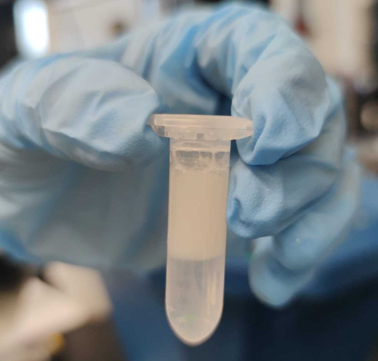 Figure 1. Representative result of overlaying 25% Iodixanol+sample solution over 29% Iodixanol solution. Figure 1. Representative result of overlaying 25% Iodixanol+sample solution over 29% Iodixanol solution.