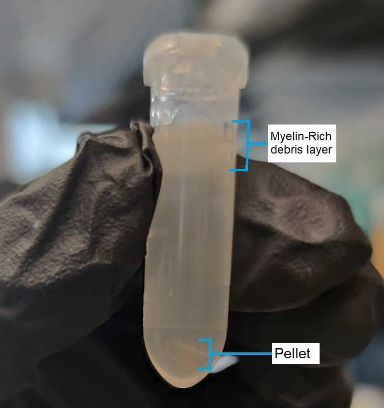 Figure 2. A representation of what should result after centrifuging the different concentrations of Iodixanol solution. Figure 2. A representation of what should result after centrifuging the different concentrations of Iodixanol solution.