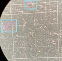 Figure 5. A 4x objective view of what nuclei and debris look like on a hemocytometer. The highlighted squares depict large nuclei clumping that can be encountered during the protocol. Figure 5. A 4x objective view of what nuclei and debris look like on a hemocytometer. The highlighted squares depict large nuclei clumping that can be encountered during the protocol.