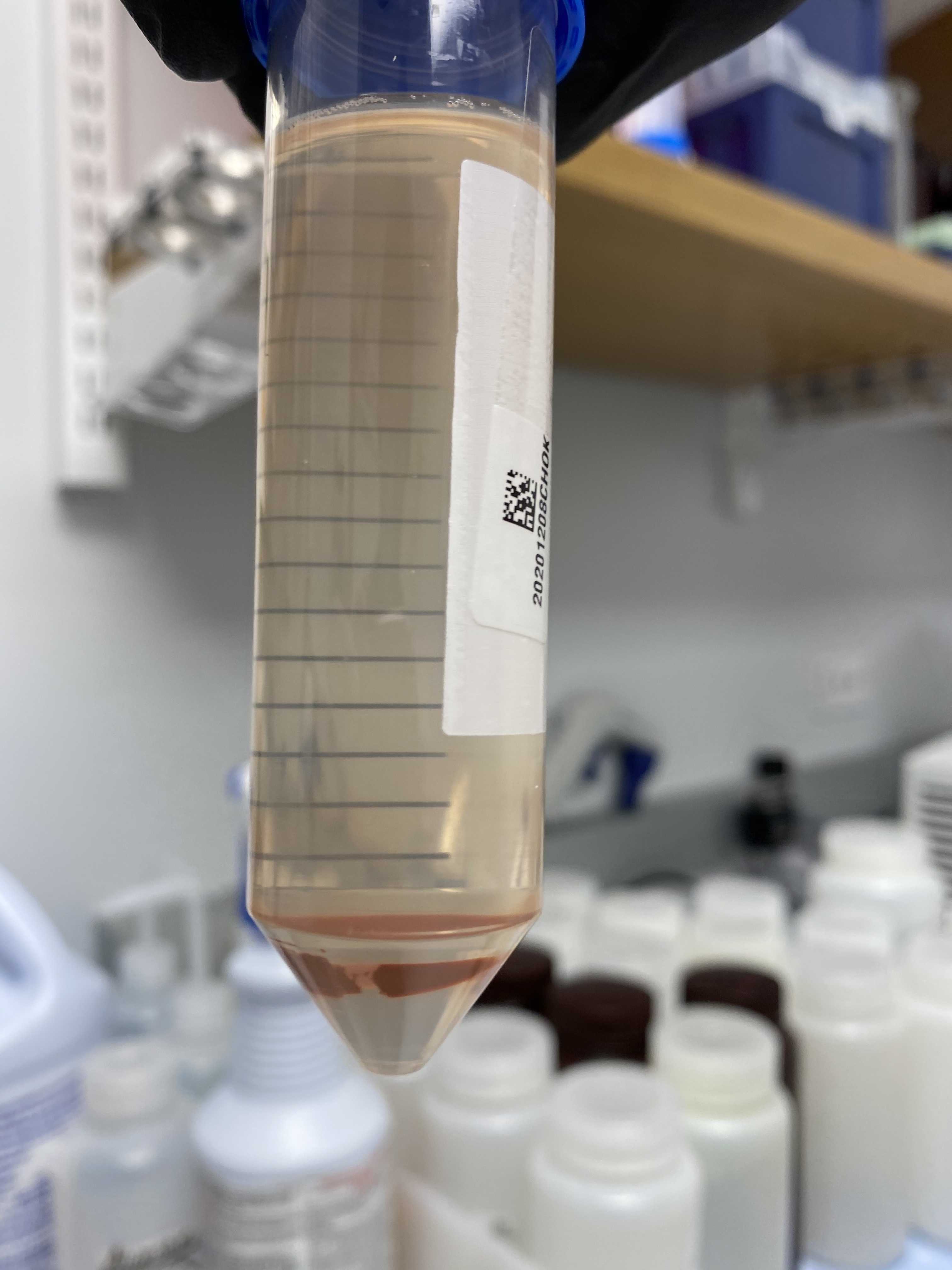 Wastewater sample with Magnetic Nanotrap particles completely out of solution following magnet incubation. Wastewater sample with Magnetic Nanotrap particles completely out of solution following magnet incubation.