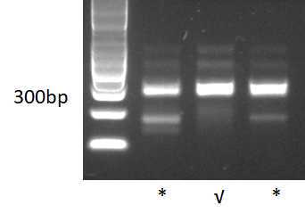 Illumina PCR producton agarose gel Illumina PCR producton agarose gel