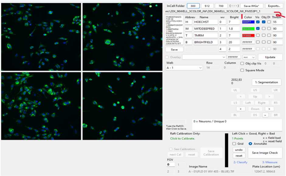 Figure 1: GIU with scanned images. Figure 1: GIU with scanned images.