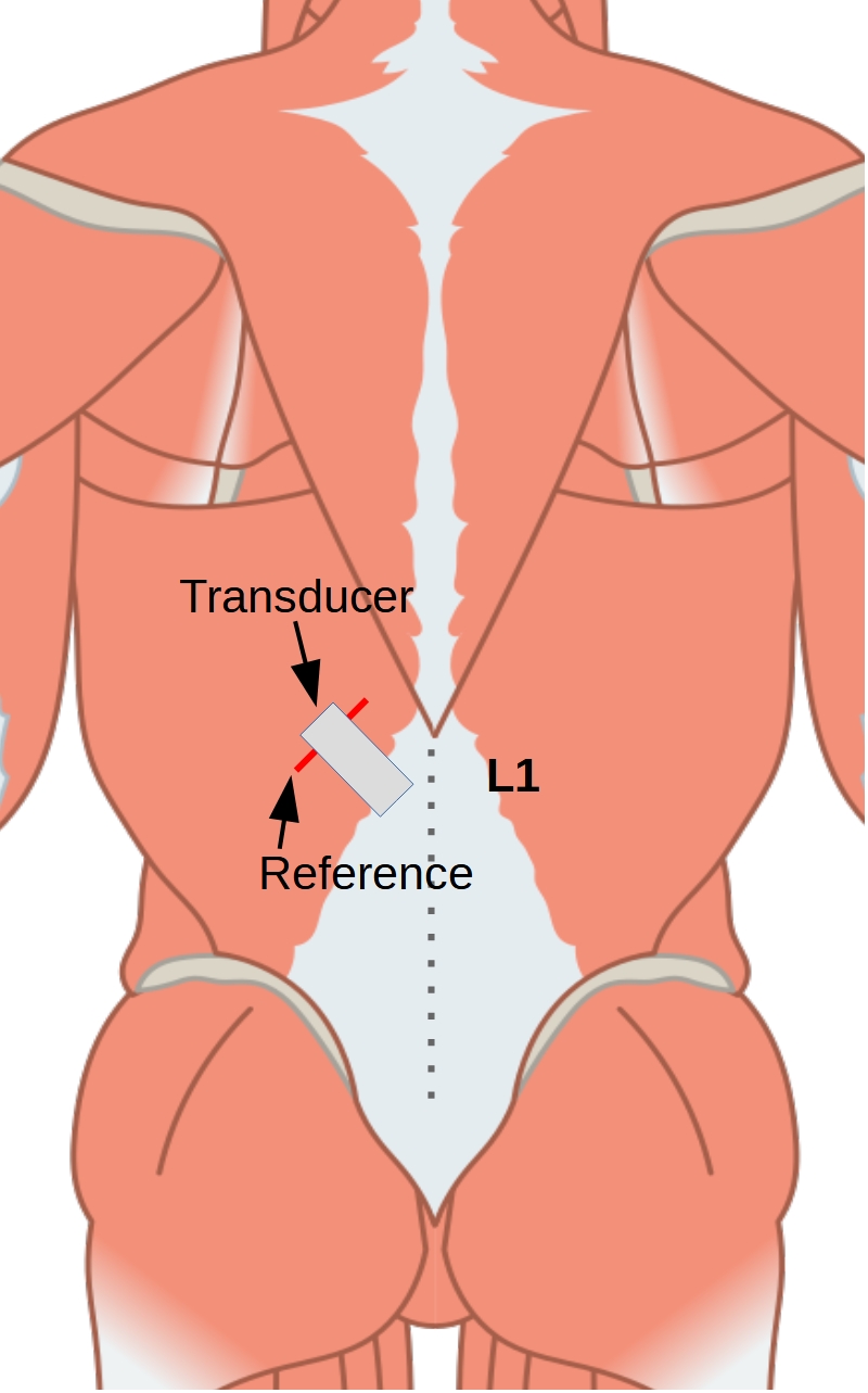 Figure 3. Measurement setup. Figure 3. Measurement setup.