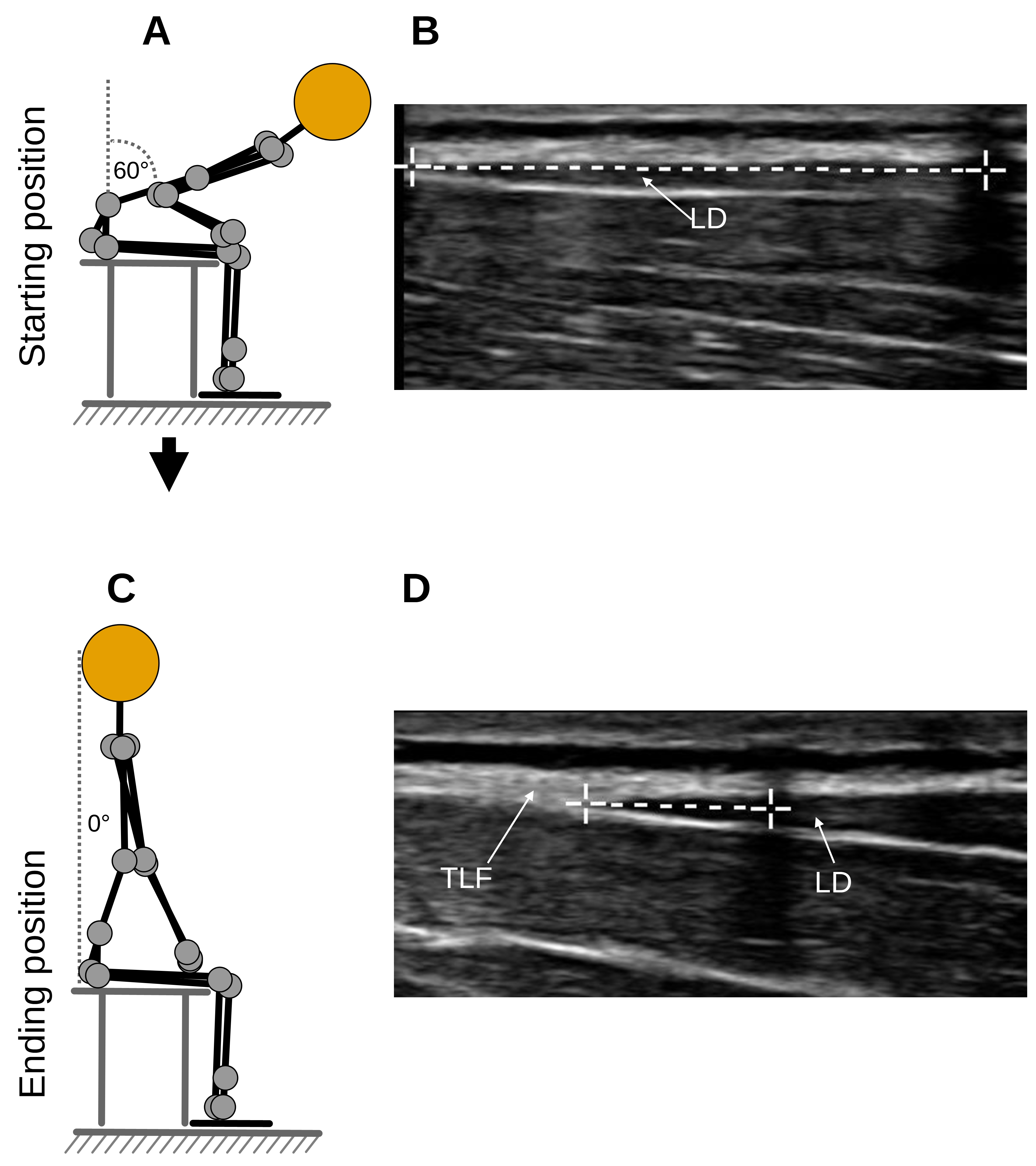 Figure 5. Measurement procedure. (A) Flexion phase trunk extension task. (B) Measurement time point t1. (C) Fully extended position of trunk extension task. (D) Measurement time point t2. TLF, thoracolumbar fascia; LD, latissimus dorsi muscle. Figure 5. Measurement procedure. (A) Flexion phase trunk extension task. (B) Measurement time point t1. (C) Fully extended position of trunk extension task. (D) Measurement time point t2. TLF, thoracolumbar fascia; LD, latissimus dorsi muscle.