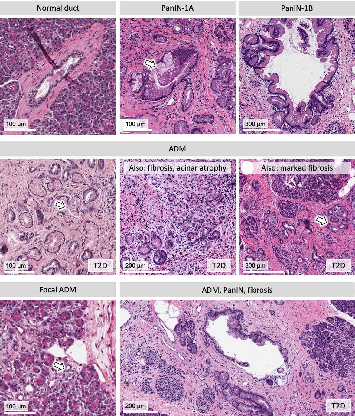 Figure 6. A range of ductal morphological features. Figure 6. A range of ductal morphological features.