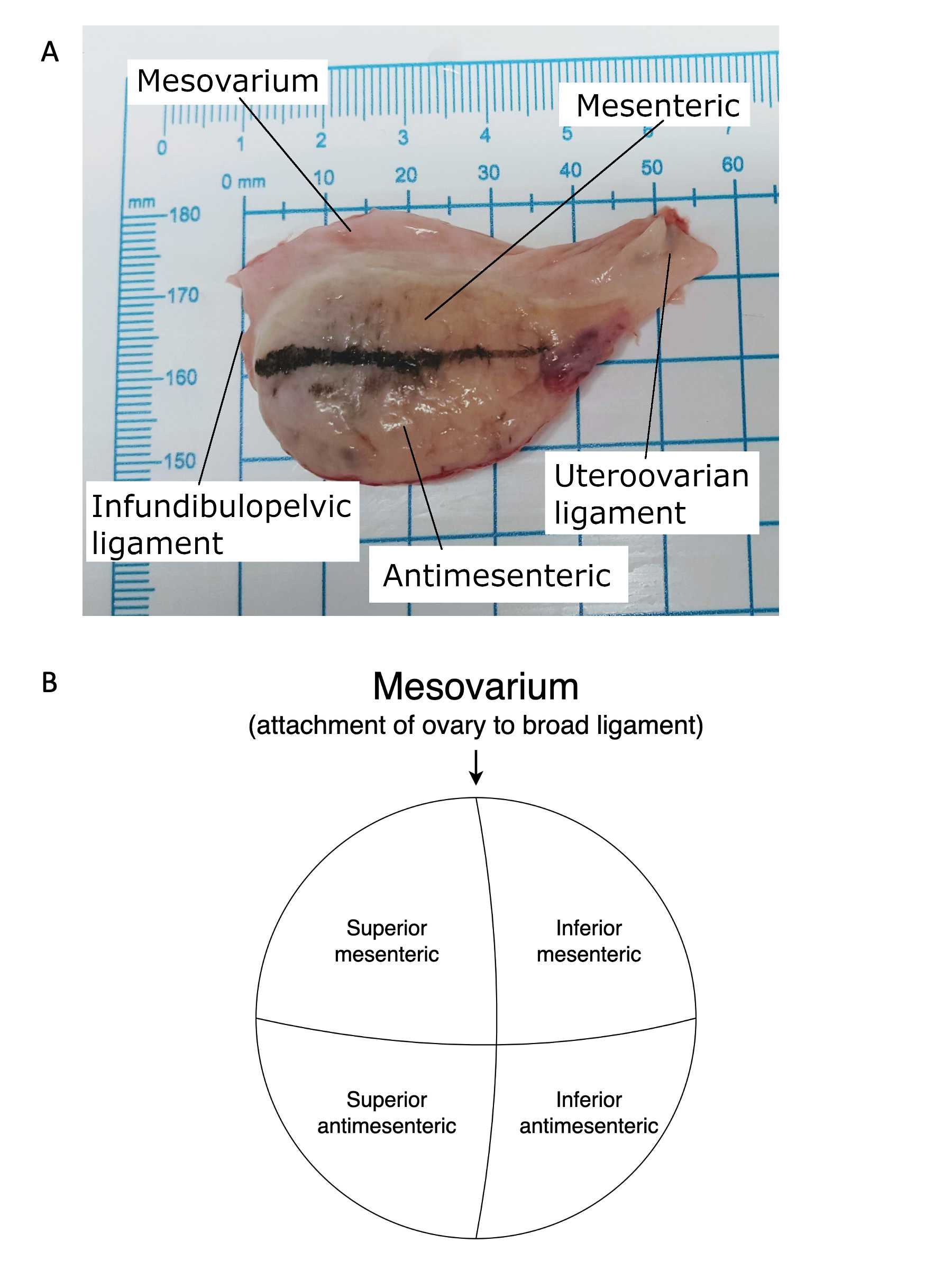 Figure 1. Use of fixed anatomic structures in the ovary. There is laxity in the structures supporting the position of the ovary which results in both intra- and inter-individual variations in the organ’s orientation within the pelvis. In order to standardize collection and maintain orientation of tissue sections, a model proposed at a NICHD-sponsored workshop that used fixed anatomic structures to create a regional map of the ovary, was applied. Here the black line was drawn on the inferior half of the ovary when it is divided by its attachment to the mesovarium. The line delineates the mesenteric and antimesenteric portions of the inferior aspect of the right ovary. Figure 1. Use of fixed anatomic structures in the ovary. There is laxity in the structures supporting the position of the ovary which results in both intra- and inter-individual variations in the organ’s orientation within the pelvis. In order to standardize collection and maintain orientation of tissue sections, a model proposed at a NICHD-sponsored workshop that used fixed anatomic structures to create a regional map of the ovary, was applied. Here the black line was drawn on the inferior half of the ovary when it is divided by its attachment to the mesovarium. The line delineates the mesenteric and antimesenteric portions of the inferior aspect of the right ovary.